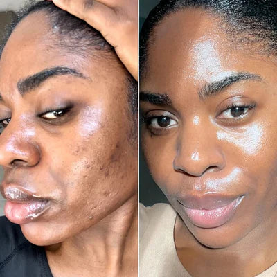 Kojic + Turmeric Body Peel Spray