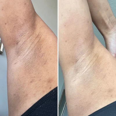 Kojic + Turmeric Body Peel Spray