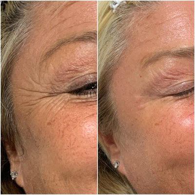 Qora Cemenrete Calcium Multi Balm