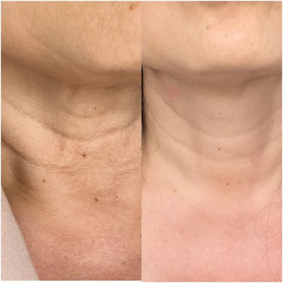 Qora Cemenrete Calcium Multi Balm